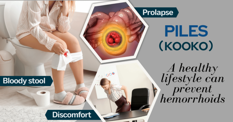 piles/kooko showing bloody stool and rectal prolapse